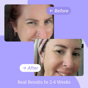 Eyes & Smile Wrinkle Patches