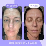 Mouth & Lip Wrinkle Patches